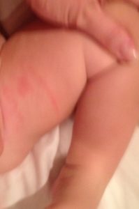 Organic Argan Oil for Diaper Rash