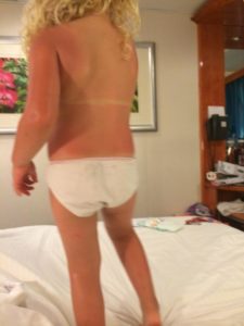 Argan Oil After Sun Care Before