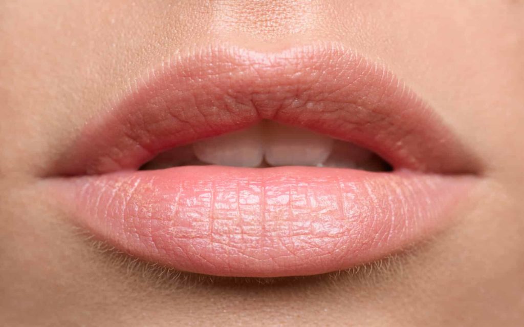 chapped lips, natural lips, nude lip