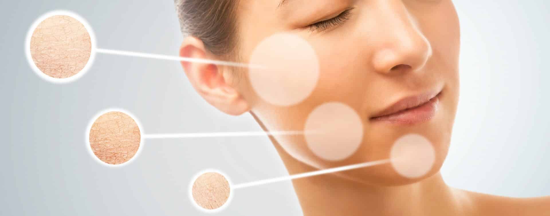 how to avoid dry skin