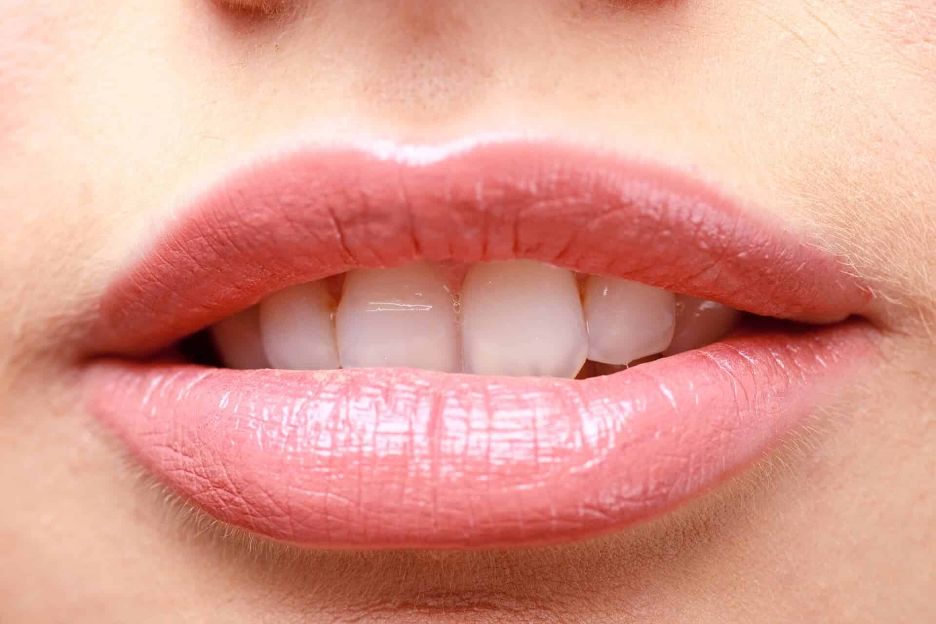 Chapped Lips, Nude Lip, Lip Balm